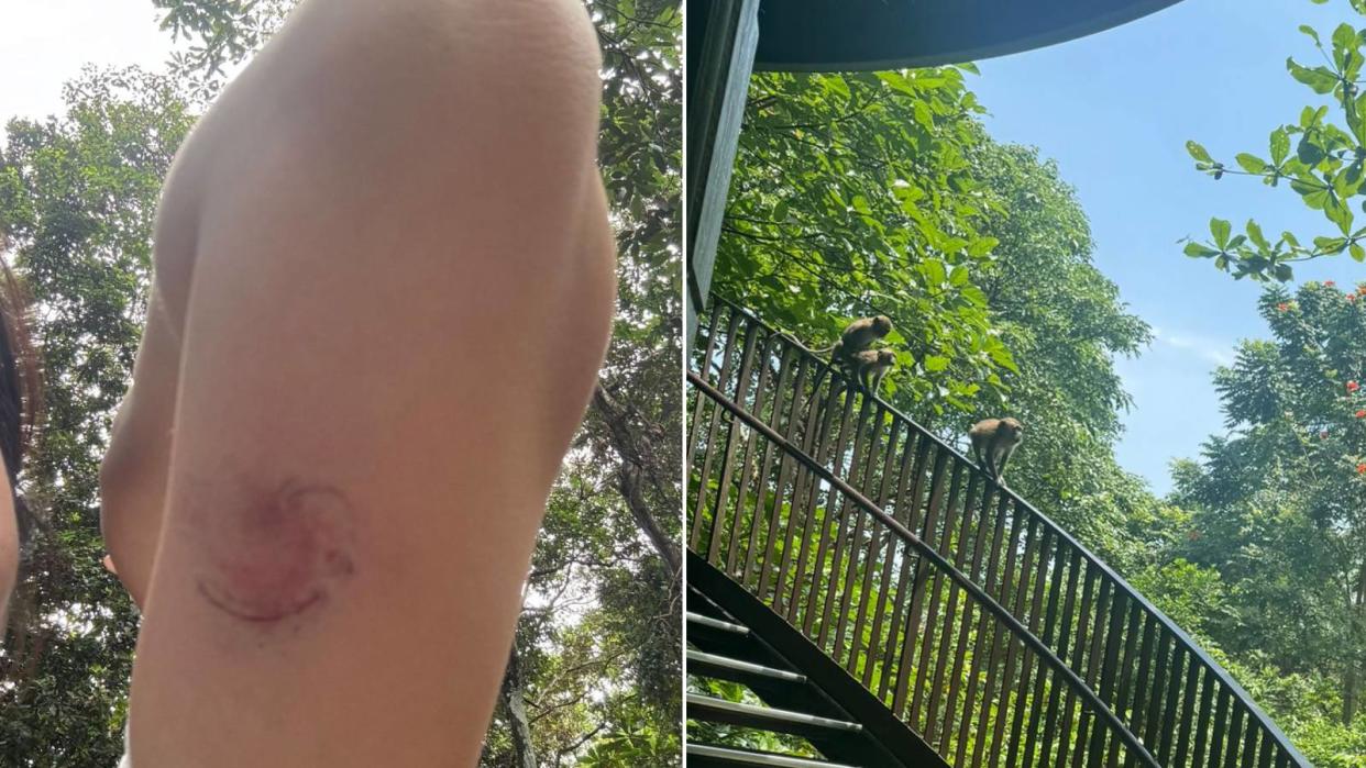 As an experienced hiker, Hoang did not expect to be bitten by a monkey at Chestnut Nature Park. (Photos: Amy Hoang) 