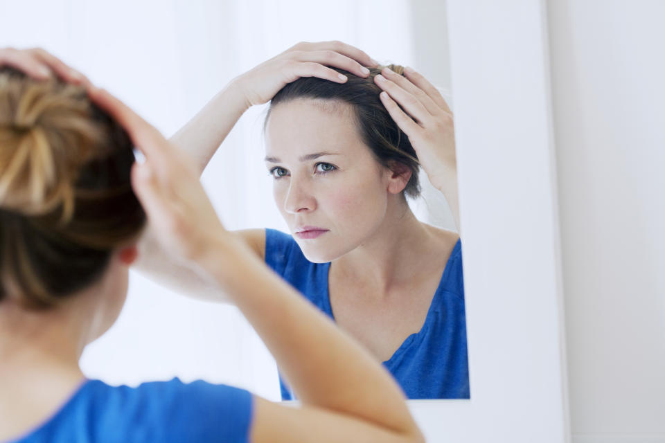 熟齡頭皮容易遇到髮線變高、落髮等問題。（圖片來源：Getty Image）