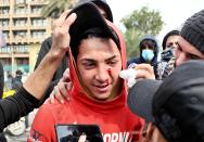 An anti-government protester, who was shot with an air rifle by police, is taken to receive first aid during clashes with security forces in Baghdad, Iraq, Wednesday, Jan. 29, 2020. (AP Photo/Hadi Mizban)