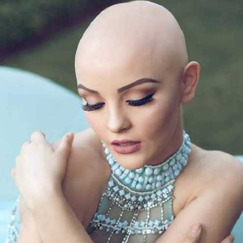 This teen girl’s fiercely gorgeous photos about losing her hair to chemotherapy are going viral