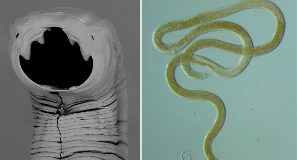 Extreme close up of a Hookworm (left) and a Roundworm (right).