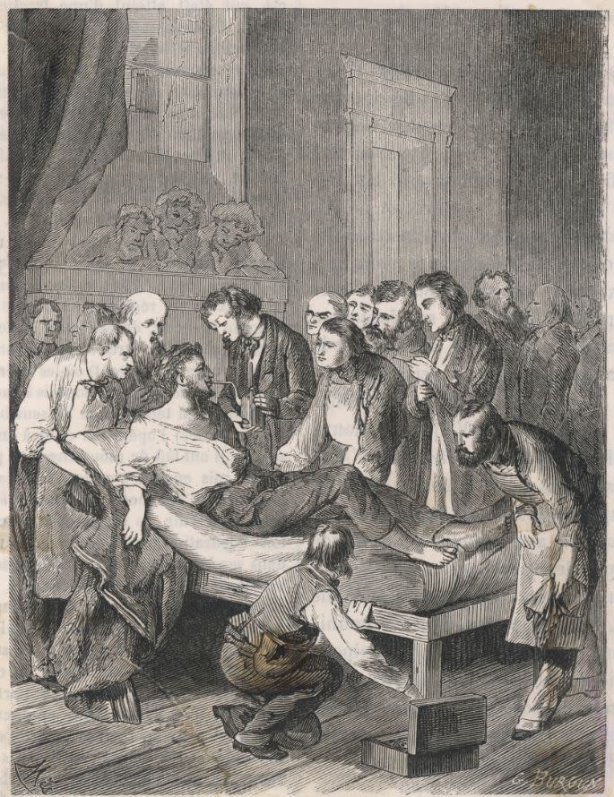 Der "Äthertag von Boston" gilt als Geburtsstunde der Anästhesie. Am 16. Oktober 1846 operierte der Zahnarzt William Thomas Green Morton seinen Patienten, nachdem er ihn mit Ätherdämpfen betäubte – der musste somit nichts von der Behandlung spüren. (Bild-Copyright: Historia/REX/Shutterstock)