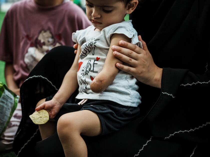 A 1-year-old with one arm amputated below her elbow sits on a woman's lap. 