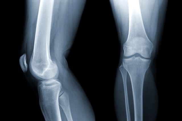 x ray of a regular knee joint...