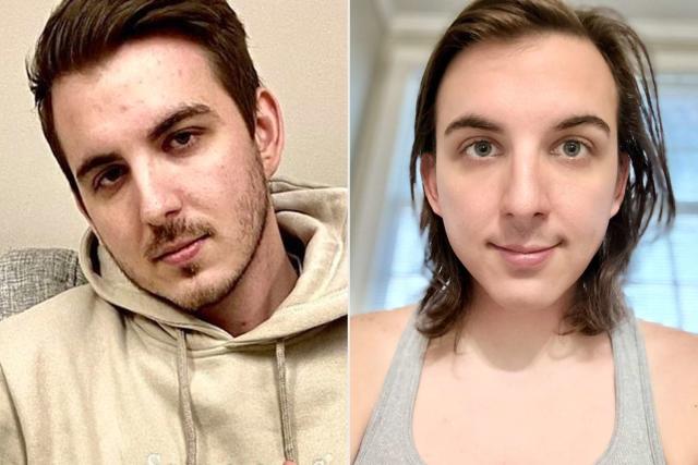 MrBeast  Star Chris Tyson Shows Off Transformation After Starting  Hormone Replacement Therapy