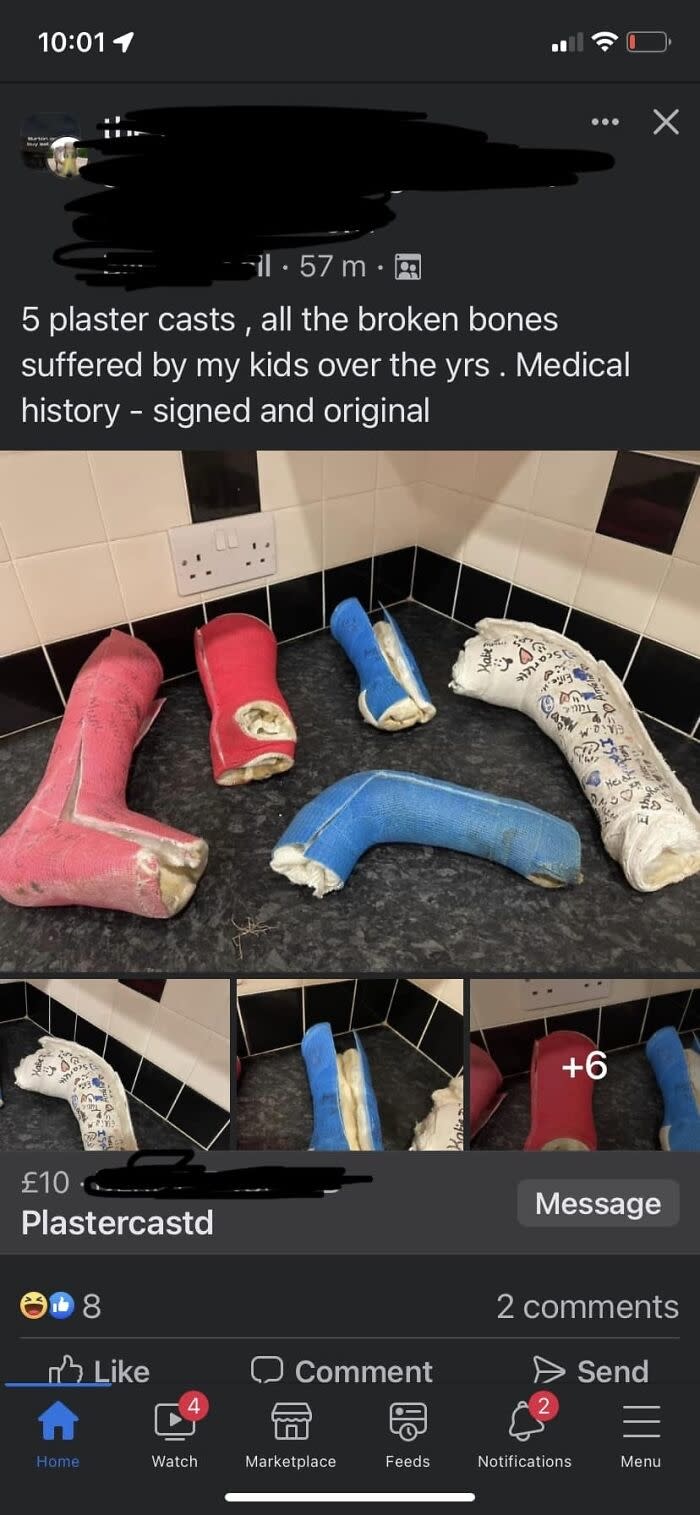 Image of five plaster casts showing details of injuries and signatures, labeled with a text post describing their origins as being from the poster's kids over the years. Summarized text: 5 plaster casts of kids' broken bones, signed and original, for sale