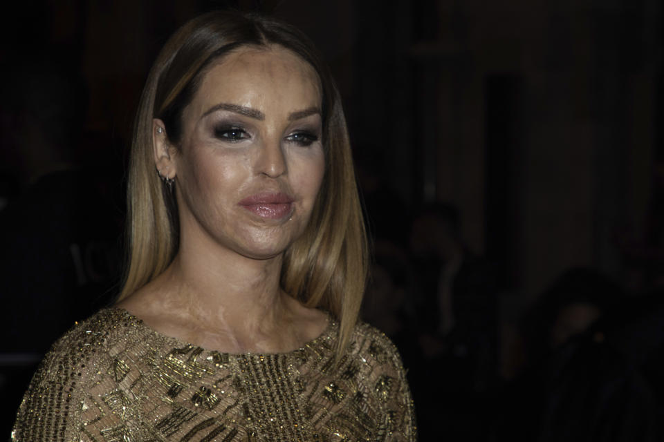 Katie Piper poses for photographers ahead of the Julien Macdonald Spring/Summer 2020 fashion week runway show in London, Monday, Sept. 16, 2019. (Photo by Vianney Le Caer/Invision/AP)