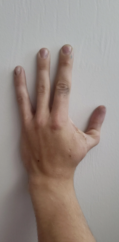 A person's right hand making a three-fingered gesture against a plain wall