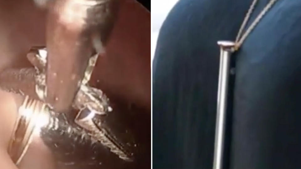 The sex toy hanging on its necklace is pictured right. Pictured left is the toy being surgically removed from the woman's bladder. Source: KMOV4