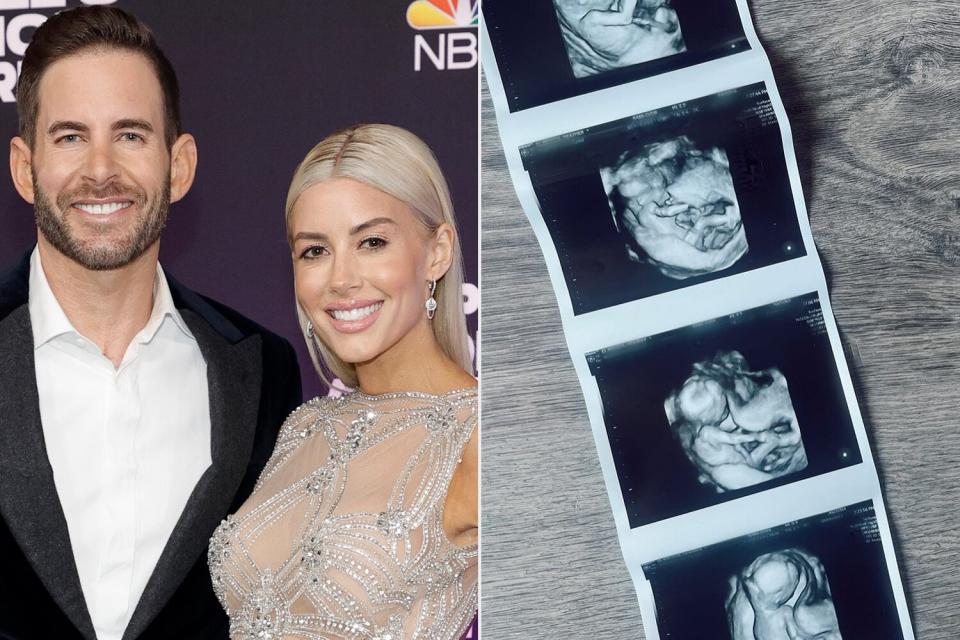 Tarek El Moussa and Heather Rae El Moussa, ultrasound