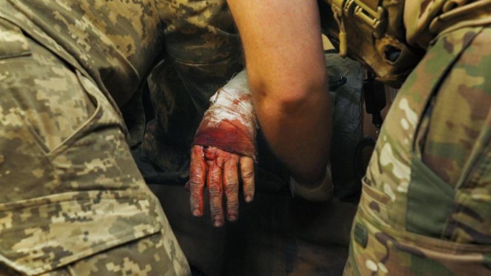 這位傷勢嚴重的士兵，他的左手雖然已經被夾板固定，並用紗布纏繞，鮮血仍汨汨滲出。