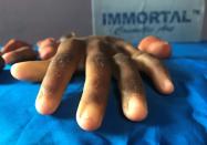 A prosthetic hand is pictured at Immortal Cosmetic Art company, in Uyo