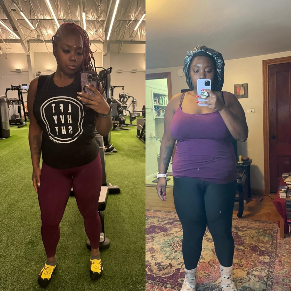 Ashlie F has lost over 146 lbs after one year of having Gastric