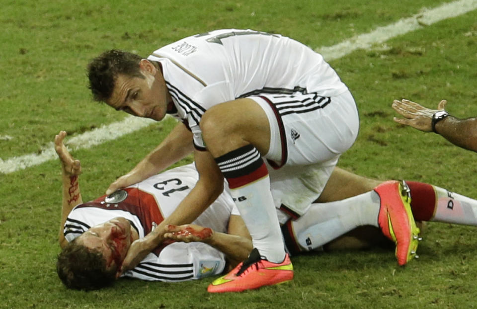After contesting a header with Ghana's John Boye and taking a shoulder to the face, German midfielder Thomas Mueller was left with a bloody cut above his eye and required five stitches. (Themba Hadebe/AP Photo)