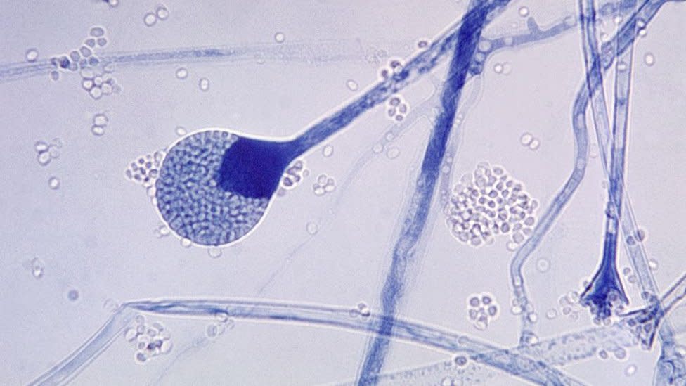 Una vista microscópica del hongo mucor