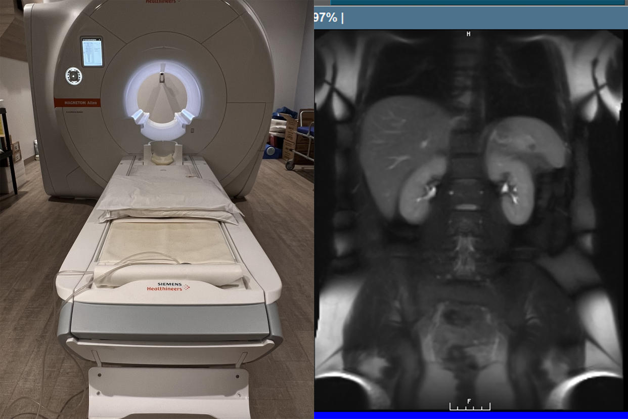 I got a full body MRI at a private clinic — here are the pros and cons.