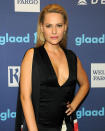 <br><i>Paralympian, model and actress: For redefining beauty</i><br><br><b>The opposite of disabled:</b> Aimee Mullins was born without fibula bones in her legs. When she was just one-year-old she underwent a double amputation below the knee and learnt to walk, run and play using prosthetic limbs. Today, she has more than a dozen pairs of them. Just don’t call Mullins, 39, disabled. "I’ve had journalists asking me, 'What do we call you – is it handicapped, are you disabled, physically challenged?'" Mullins has said. "I [replied], ‘Well, hopefully, you could just call me Aimee.'" <br><b>Normality:</b> As an athlete, TED Talk all-star, muse to the late Alexander McQueen and a global ambassador for L’Oréal, Mullins’s greatest impact might be the way she is reshaping the very meaning of the word “disabled”.<br><b>Get involved:</b> <a rel="nofollow noopener" href="http://www.aimeemullins.com/" target="_blank" data-ylk="slk:aimeemullins.com;elm:context_link;itc:0;sec:content-canvas" class="link ">aimeemullins.com</a>