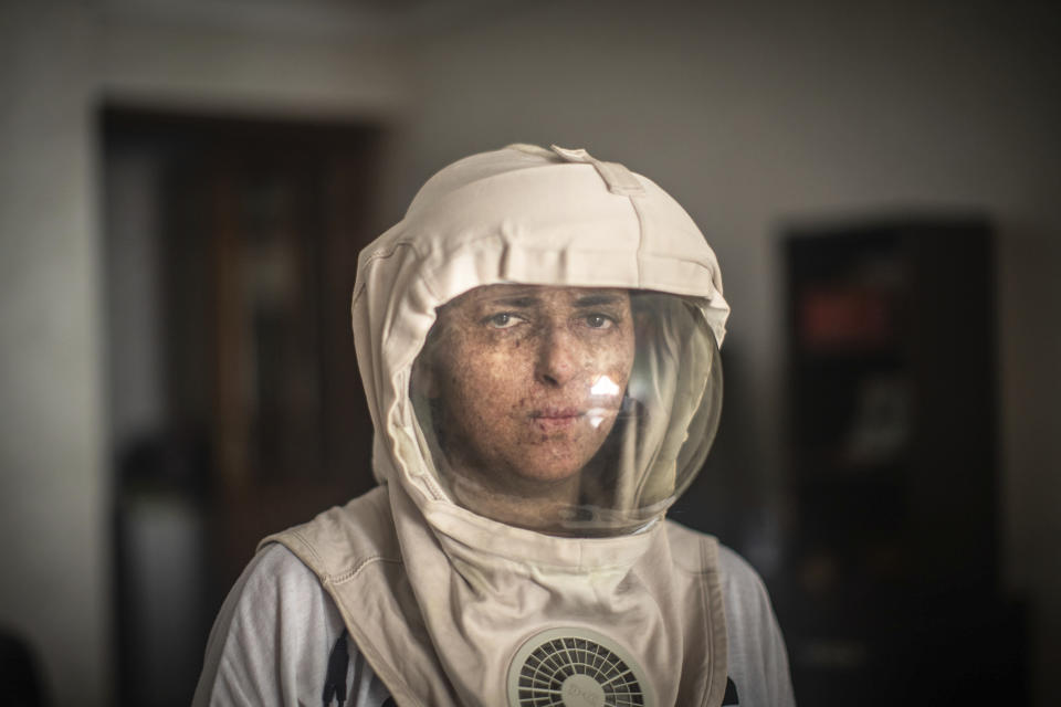 In this Tuesday, July 16, 2019 photo, Fatimazehra El Ghazaoui, 27, a woman affected by a rare disorder called xeroderma pigmentosum, or XP, poses for a portrait wearing a protective mask she wears outside on sunny days, in her home in Mohammedia, near Casablanca, Morocco. (AP Photo/Mosa'ab Elshamy)