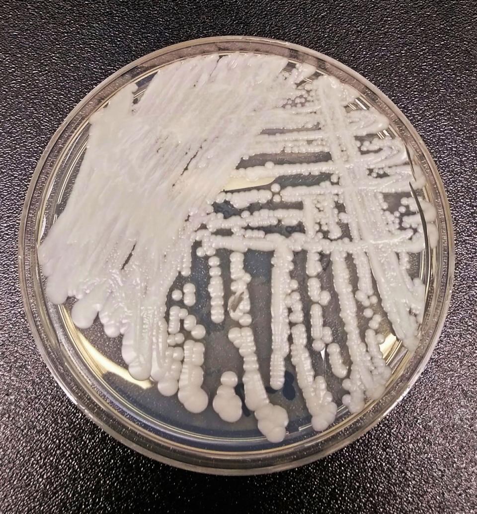 Cultured Candida auris is shown in a petri dish. A case of the drug-resistant fungus has been reported in Erie County.
