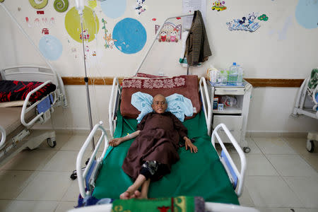 A boy who has cancer lies on a bed at The National Oncology Centre in Sanaa, Yemen, July 23, 2018. REUTERS/Khaled Abdullah