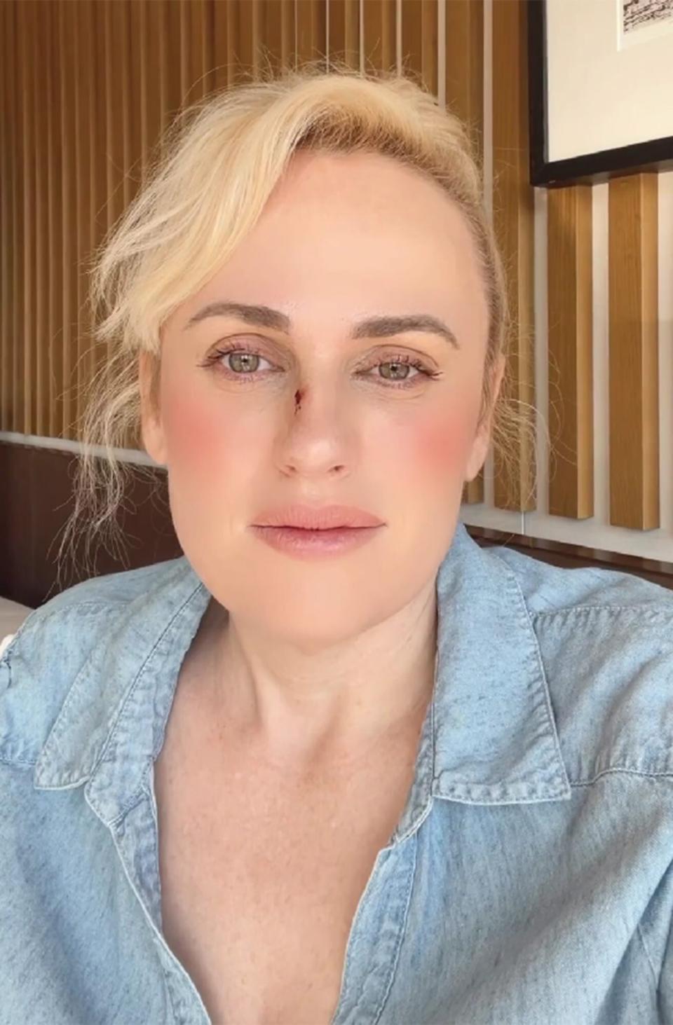 Rebel Wilson Gives Health Update After On Set Accident: 'I've Been Healing Quite Amazing'