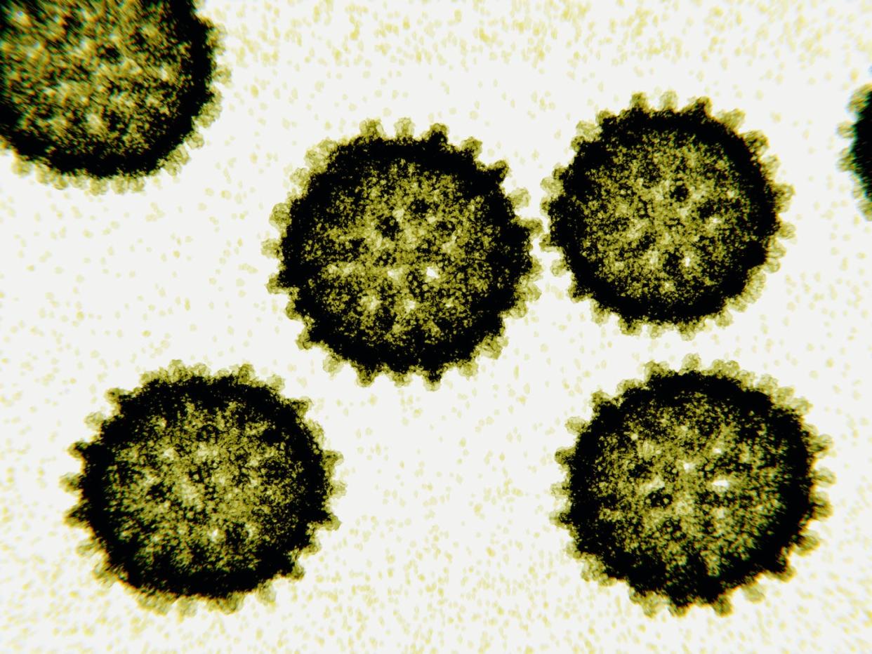 Imaging the proteins on the surface of HCV has been challenging because of the virus's shape-shifting nature. <a href="https://www.gettyimages.com/detail/illustration/hepatitis-c-virus-particles-illustration-royalty-free-illustration/1042127452" rel="nofollow noopener" target="_blank" data-ylk="slk:Juan Gaertner/Science Photo Library via Getty Images;elm:context_link;itc:0;sec:content-canvas" class="link ">Juan Gaertner/Science Photo Library via Getty Images</a>