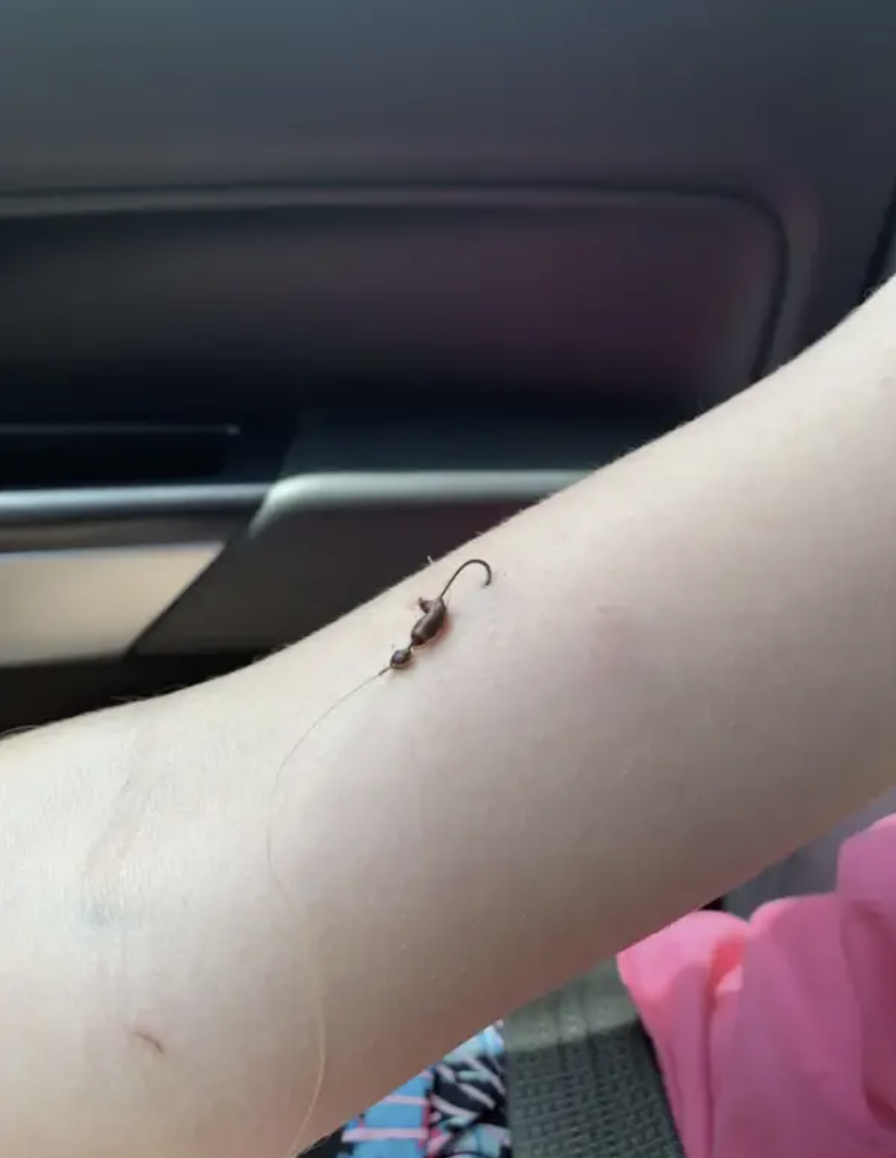 A fishing hook in someone's arm