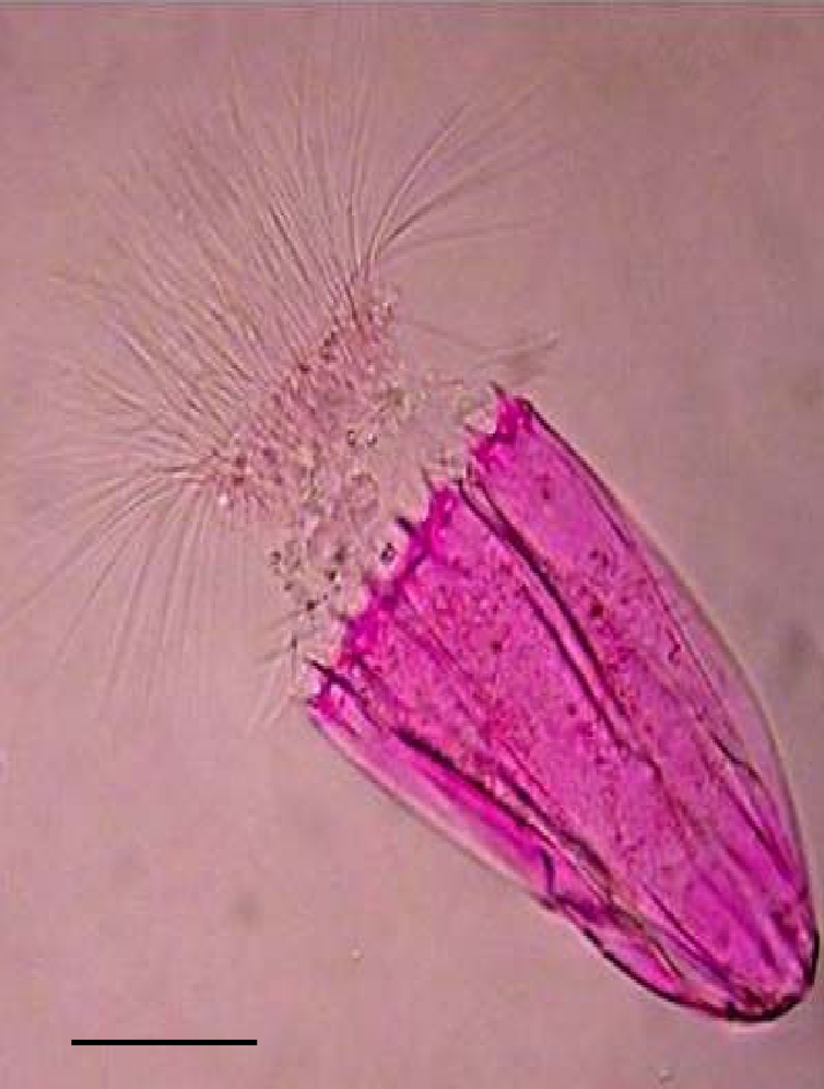 <span class="caption">Spinoloricus, a tiny but multicellular organism that apparently requires no oxygen to live. Scale bar is 50 micrometres.</span> <span class="attribution"><span class="source">Roberto Danovaro, Antonio Dell'Anno, Antonio Pusceddu, Cristina Gambi, Iben Heiner & Reinhardt Mobjerg Kristensen</span></span>