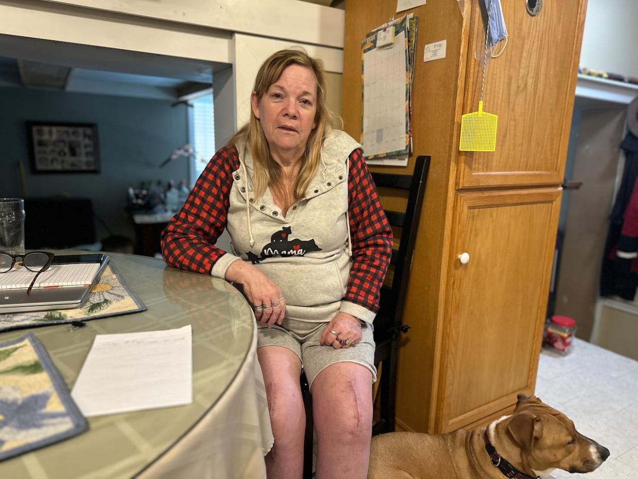 Sue Holme and her husband rent out two units of the triplex they live in in London, Ont. She says trying to get a Landlord and Tenant Board hearing to evict a tenant has left her feeling the system is 'broken.'  (Isha Bhargava/CBC - image credit)