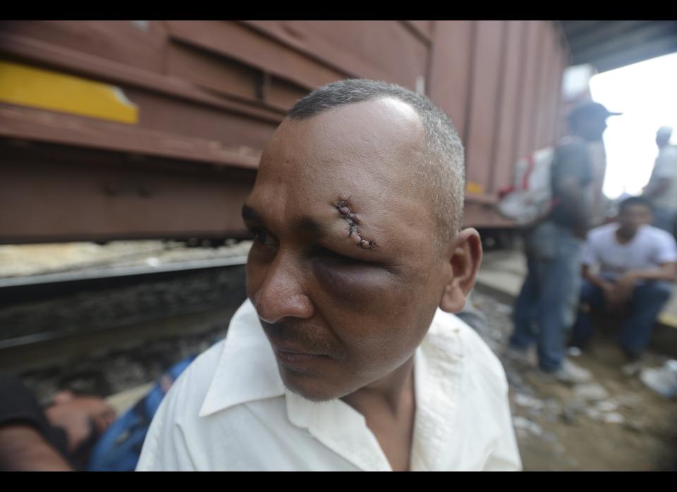 Edwin Omar Fuentes, a migrant from Honduras, stands by the train tracks as he recovers from an injury he got the night before in an altercation over a piece of clothing, in Coatzacoalcos, Mexico, Wednesday, July 11, 2012. Local officials estimate one thousand immigrants are stranded in this town after a rail bridge collapsed blocking the passage of cargo trains used by the travelers heading to the United States. While the number of Mexicans heading to the U.S. has dropped dramatically, a surge of Central American migrants is making the 1,000-mile northbound journey this year, fueled in large part by the rising violence brought by the spread of Mexican drug cartels. (AP Photo/Miguel Juarez)