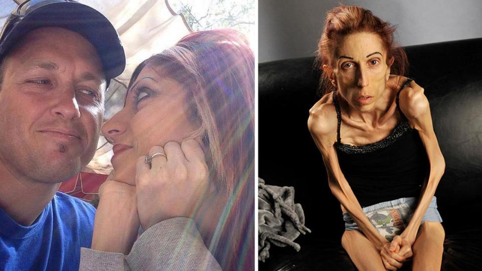 Rachael Farrokh habla de su lucha contra la anorexia