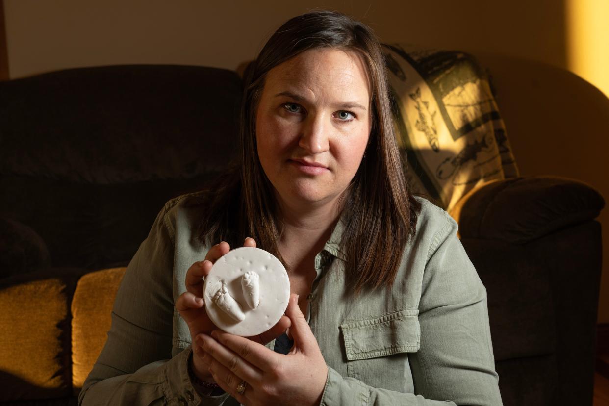 Megan Kling holds a footprint cast of her son, Nolan Robert Kling, on Wednesday, Jan. 31, 2024, at her family’s home in Taylor, Wisconsin. In November, Megan and her husband, Sam, traveled to Rochester, Minnesota, so Megan could be induced at 23 weeks gestation. The parents learned during a routine appointment that their son had developed bilateral renal agenesis, a rare and life-limiting condition in which the baby's two kidneys never develop. The condition is incompatible with life. 
(Credit: Mark Hoffman / Milwaukee Journal Sentinel)