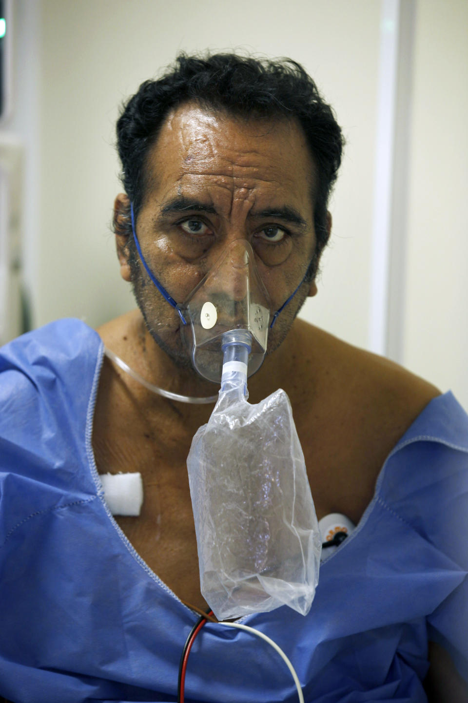 Un paciente con COVID-19 se sienta en una cama de la Unidad de Cuidados Intensivos del Hospital General Ajusco Medio de la Ciudad de México, el miércoles 2 de diciembre de 2020. (AP Foto/Marco Ugarte)