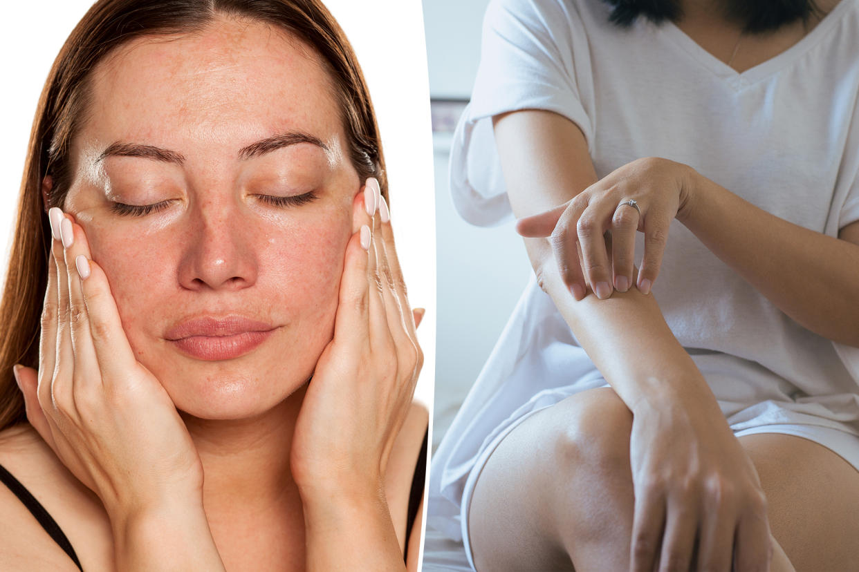 A woman with her eyes closed and a woman with her hands on her face