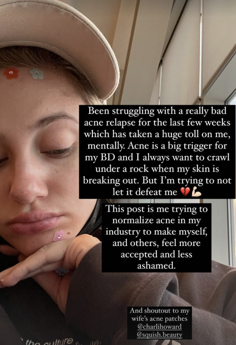 Lili Reinhart shares her struggles with body dysmorphia and acne. (Photo: Lili Reinhart/Instagram)