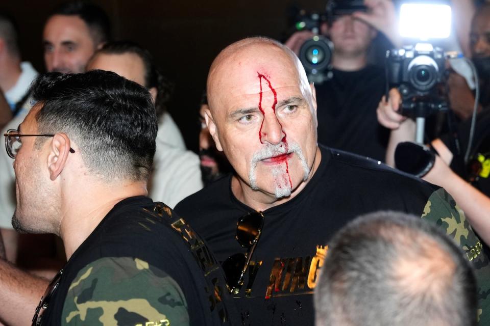 Fracas: John Fury was left bleeding after headbutting a member of Oleksandr Usyk’s entourage in Riyadh (Nick Potts/PA Wire)