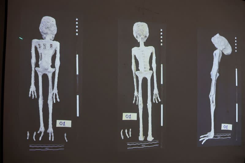 經過X光檢查及其他檢測，法醫認定可疑包裹裝的外星人遺體是假造的。（圖／路透／達志影像）