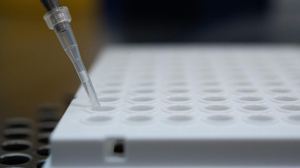 Ein PCR-Test in einem Labor in Stuttgart. Virologin Brinkmann fordert einen vermehrten Einsatz sogenannter Lollitests oder Gurgeltests. Diese können per PCR ausgewertet werden.