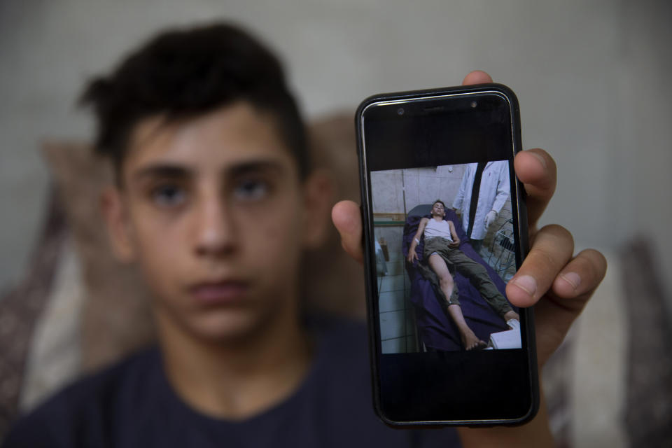 Palestinian youth, Tareq Zubeidi, 15, shows an image of his wounds at his house, in the West Bank village of Silat ad-Dhahr, Tuesday, Aug. 31, 2021. Zubeidi says he was abducted and beaten by a group of Israeli settlers after they found him and his friends eating snacks near an evacuated hilltop settlement in the occupied West Bank. More than two weeks after the Aug. 17 incident, he says he can barely walk and is afraid to leave his home. (AP Photo/Majdi Mohammed)