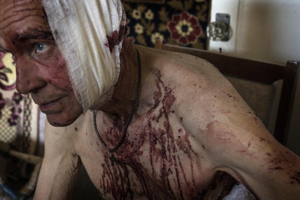 Volodymyr, de 66 años, que resultó lesionado durante un ataque en la guerra contra Rusia, permanece en una silla en su apartamento dañado, el 7 de julio de 2022, en Kramatorsk, región de Donetsk, en el este de Ucrania. (AP Foto/Nariman El-Mofty)