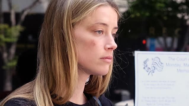 Amber Heard appeared at LA's superior court with a black eye, accusing Depp of hitting her. Photo: AP