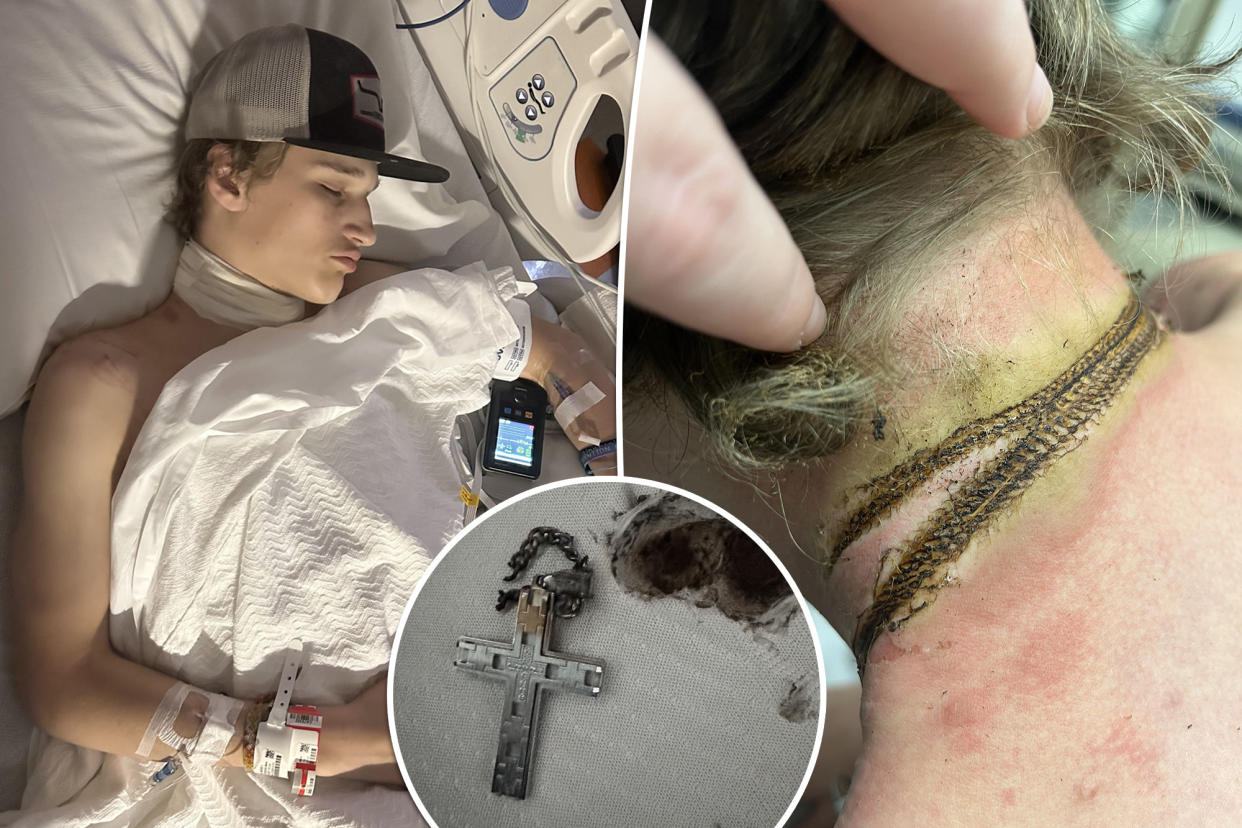 Oklahoma teen Rayce is lucky to be alive after his religious crucifix electrocuted him like a 