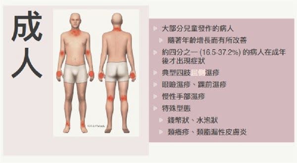 （圖片提供／陳冠伃醫師表）