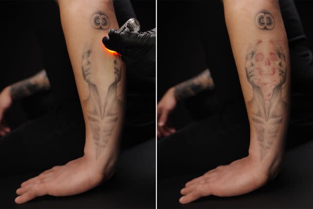 <p>Bang Bang</p> Magic Ink tattoo in action