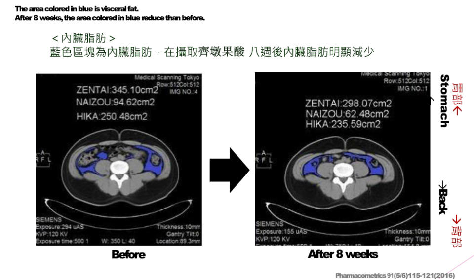 齊墩果使用八週 人體實驗電腦斷層掃描（圖片來源：法國Phytodia實驗室）