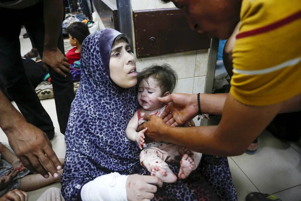 Injured Palestinians are brought to Al Aqsa Martyrs Hospital after the Israeli attacks on the camps in central Gaza on June 8, 2024.  (Anadolu via Getty Images)