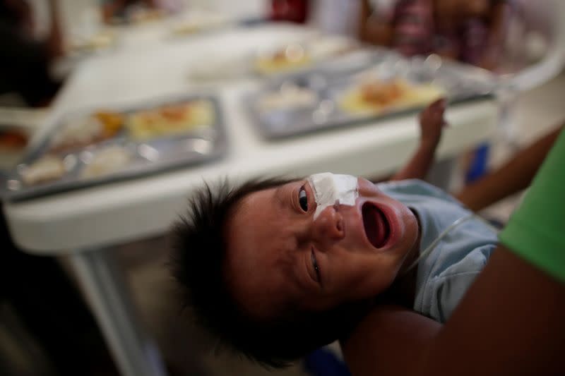 A child of the indigenous Wichi community cries while using a feeding tube, at a hospital, in Tartagal, in the Salta province