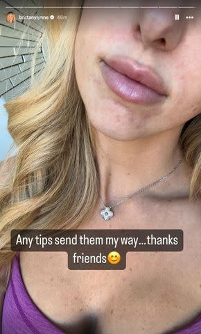 <p>Instagram/brittanylynne</p> Brittany Mahomes asks her Instagram followers for tips on how to treat her current breakouts