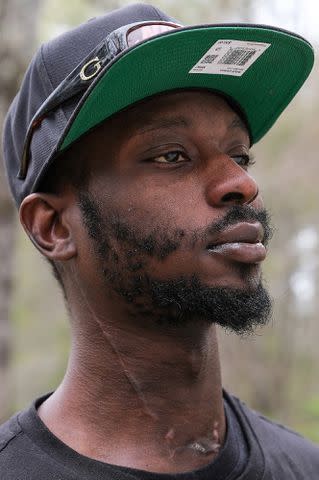 <p>AP Photo/HG Biggs</p> A scar runs down Michael Corey Jenkins's neck, following the Jan. 2023 attack by White law enforcement officers.