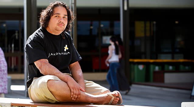 He said he hopes to one day meet his attacker. Photo: AAP / Cameron Laird